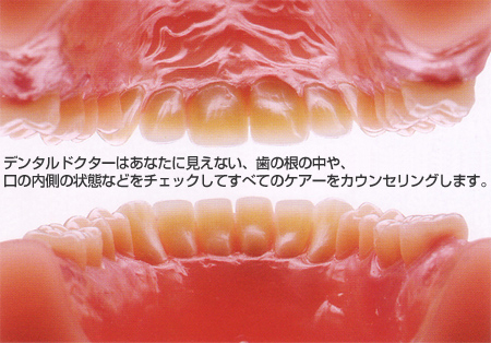 f^hN^[ׂ͂ẴPA[JEZO܂