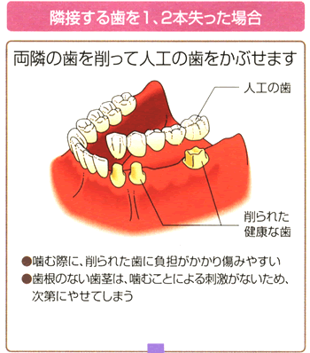 אڂ鎕1A2{ꍇ